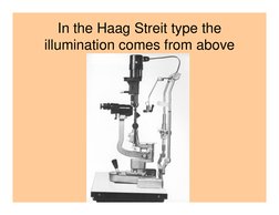 In the Haag Streit type the 
illumination comes from above

