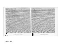 Yilmaz, 2001	

