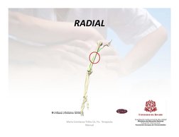RADIAL
RADIAL
María Constanza Trillos Ch, Fis.  Terapeuta 
Manual
