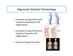 Alignment	  Varia-on	  Terminology	  
– Increased	  curving	  of	  the	  spine	  
outward	  or	  backward	  in	  