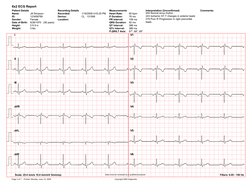Universal ECG Sample Reports | PDF | Electrocardiography | Heart