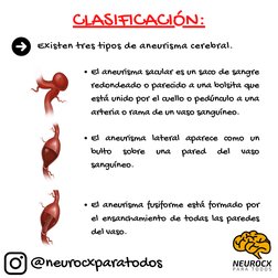 El aneurisma sacular es un saco de sangre
redondeado o parecido a una bolsita que
está unido por el cuello o pedúnculo a una