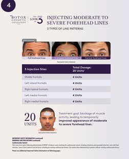 Botox Art of Injection Guide | PDF | Botulinum Toxin | Medicine