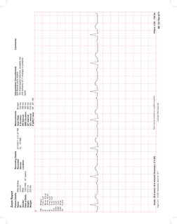 ECG Sample Report | PDF | Electrocardiography | Cardiology