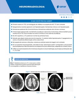 3
NEURORRADIOLOGIA
O QUE VOCÊ PRECISA SABER?
	
u Primeiro exame no TCE, na investigação de cefaleia e na suspeita de AVC: TC
