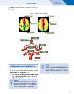 Neurorradiologia
﻿
5
Dica 3: Vascularização cerebral e principais marcos ana-
tômicos.
Figura 3. Vascularização cerebral.
Fon