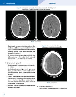 Neurorradiologia
Radiologia
6
Figura 4. Cortes axiais normais de TC de crânio, mostrando glândula pineal 
(à esquerda) e plex