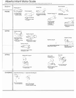 Alberta Infant Motor Scale Overview | PDF | Anatomical Terms Of Motion ...