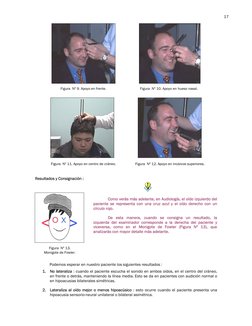 17 
 
 
 
 
 
 
 
 
 
 
 
 
 
Resultados y Consignación : 
 
 
Como verás más adelante, en Audiología, el oído izquierdo de