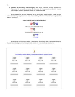 18 
3. Lateraliza al oído peor o más hipoacúsico : esto ocurre cuando el paciente presenta una 
hipoacusia de conducción un