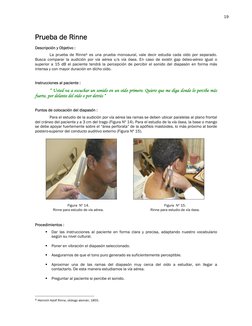19 
 
 
Prueba de Rinne 
 
Descripción y Objetivo : 
 
La prueba de Rinne5 es una prueba monoaural, vale decir estudia cada