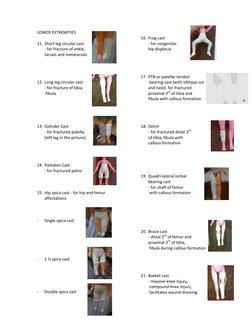 LOWER EXTREMITIES 
 
11. Short leg circular cast  
- for fracture of ankle,  
tarsals and metatarsals 
 
 
 
 
12. Long leg c