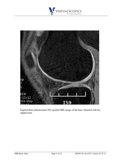 Mri Knee Ordering Guide.pdf MRI Knee Anatomy Atlas | PDF | Knee | Lower Limb Anatomy