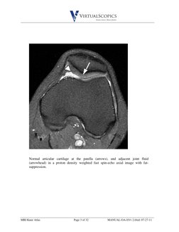 Mri Knee Ordering Guide.pdf MRI Knee Anatomy Atlas | PDF | Knee | Lower Limb Anatomy