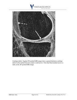 Mri Knee Ordering Guide.pdf MRI Knee Anatomy Atlas | PDF | Knee | Lower Limb Anatomy