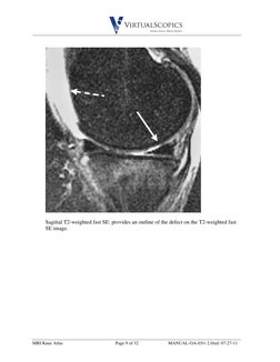 Mri Knee Ordering Guide.pdf MRI Knee Anatomy Atlas | PDF | Knee | Lower Limb Anatomy