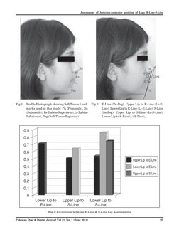 E-Line and S-Line Lip Assessment Study | PDF | Orthodontics | Standard ...
