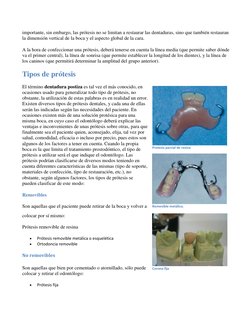 importante, sin embargo, las prótesis no se limitan a restaurar las dentaduras, sino que también restauran 
la dimensión vert