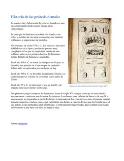 Historia de las prótesis dentales 
La confección y fabricación de prótesis dentales es una 
tarea importante desde mucho tiem