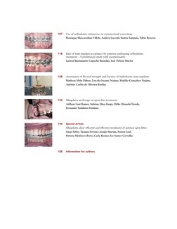 107	
Use of orthodontic miniscrews in asymmetrical corrections
	
Henrique Mascarenhas Villela, Andréa Lacerda Santos Sampaio,