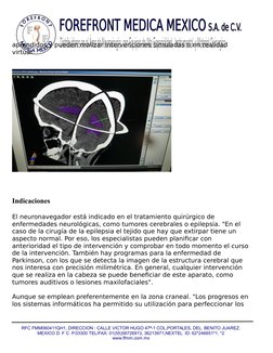 aprendidos y pueden realizar intervenciones simuladas o en realidad 
virtual. 
Indicaciones
El neuronavegador está indicado e