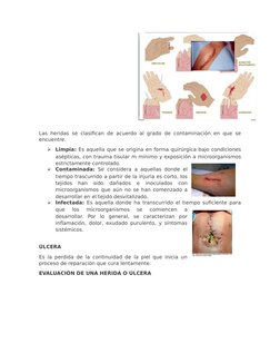 Las heridas se clasifican de acuerdo al grado de contaminación en que se
encuentre.

Limpia: Es aquella que se origina en fo