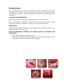 PAPANICOLAU
Es una prueba sencilla y rápida, en la que se introduce un especulo, que separa
las paredes de la vagina para pod