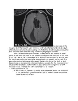 You can see at the 
margins that there’s only very minimal contrast enhancement with the bulk 
of the tumor completely attenu