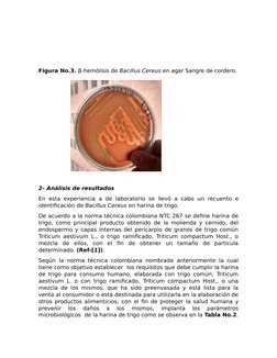 Figura No.3. β-hemólisis de Bacillus Cereus en agar Sangre de cordero.
2- Análisis de resultados
En esta  experiencia  a  de
