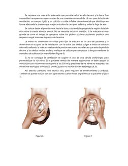 Se requiere una mascarilla adecuada que permita incluir en ella la nariz y la boca. Son 
mascarillas transparentes que consta