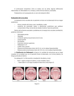 A continuación revisaremos cómo se evalúa una vía aérea, algunas definiciones 
relacionadas con dificultades en su manejo y c