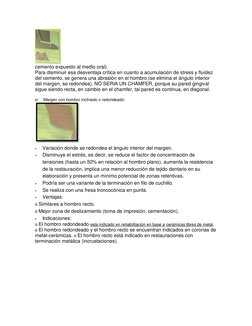 cemento expuesto al medio oral). 
Para disminuir esa desventaja crítica en cuanto a acumulación de stress y fluidez 
del ce