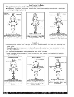 Premier Research Labs  •  www.prlabs.com   •  (800) 325-7734  •  fax  (512) 341-3931
Injections
Q-18
30-Year-Old Horse Traine