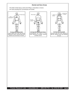 75-Year-Old Retired CEO
Lower lateral front tooth with decay 
reﬂexing to heart, causing heart pal-
pitations and shortness o