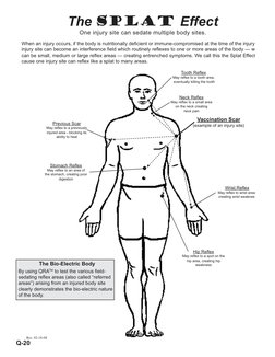 The Splat Effect
One injury site can sedate multiple body sites.
When an injury occurs, if the body is nutritionally deﬁcient