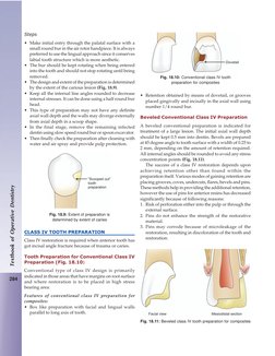 284
Textbook of Operative Dentistry
Steps
• Make initial entry through the palatal surface with a
small round bur in the air