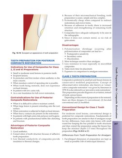 287
Tooth Preparation for Composite Restorations
TOOTH PREPARATION FOR POSTERIOR
COMPOSITE RESTORATION
Indications for Use of