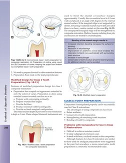 288
Textbook of Operative Dentistry
2. No need to prepare dovetail or other retention features
3. Preparation floor need not