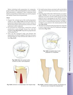 289
Tooth Preparation for Composite Restorations
Before initiating tooth preparation for composite,
proper isolation of the o