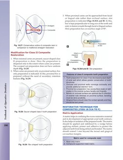 290
Textbook of Operative Dentistry
Modification for Class II Composite
Restoration
1. When minimal caries are present, sauce