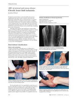 Arterial and Venous Disease Overview | PDF | Ischemia | Pulse