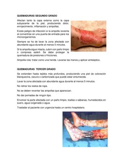QUEMADURAS SEGUNDO GRADO 
Afectan tanto la capa externa como la capa 
subyacente de la piel, produciendo dolor, 
enrojecimien