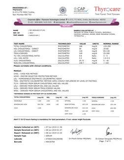 Thyrocare
D-37/1,TTC MIDC,Turbhe,
Navi Mumbai-400 703
PROCESSED AT :
NAME
 
SELF
MD ARSHAD(37Y/M)
REF. BY
TEST ASKED
AAROGYAM