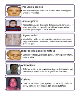 Por uremia crónica
• Piel amarillenta por reducción actínica de los cromógenos 
urinarios retenidos
Acromegálicas
• Rasgos tó