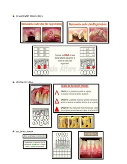 REMANENTES RADICULARES: 
 
 
 
 
 
 
 
 
 
 
 
 
 
 
 
 
 
 
 
 
 
 LESIÓN DE FURCA:  
 
 
 
 
 
 
 
 
 
 
 ENCÍA INSERTADA