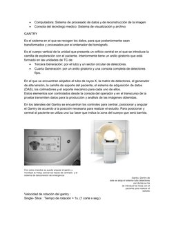 
Computadora: Sistema de procesado de datos y de reconstrucción de la imagen

Consola del tecnólogo medico: Sistema de visu
