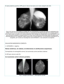 El valor predictivo positivo (VPP) para el cáncer de mama es en esta categoría del 13%
(Fig.2) Se trata de una imagen en espe