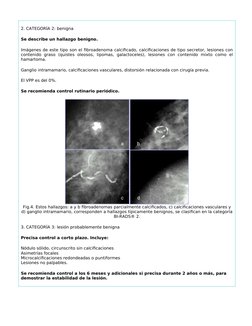 2. CATEGORÍA 2: benigna
Se describe un hallazgo benigno. 
Imágenes de este tipo son el fibroadenoma calcificado, calcificacio