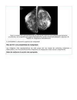Fig.6. La lesión más representativa de de este grupo, sería la masa palpable parcialmente
circunscrita, con ecografía que sug