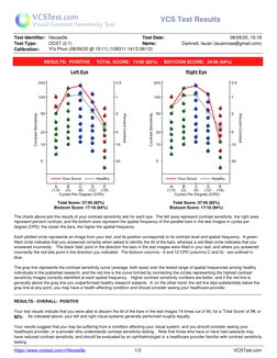 VCS Test Results
Test Identifier: f4ecee9e
Test Type:
OCST (2.1)
Test Date:
08/09/20, 15:18
Name:
Darknell, Ieuan (ieuanrose@